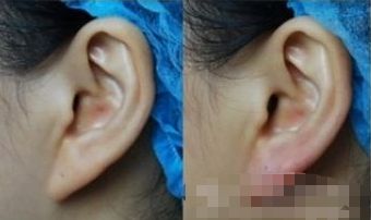 湖州哪家醫(yī)院能有效提升面部外觀？