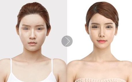 沭陽縣人民醫(yī)院燒傷外科服務(wù)及收費解析，醫(yī)生挑選技巧揭秘！