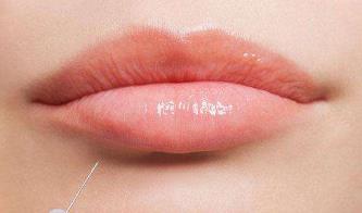 河南水柔豐胸醫(yī)生