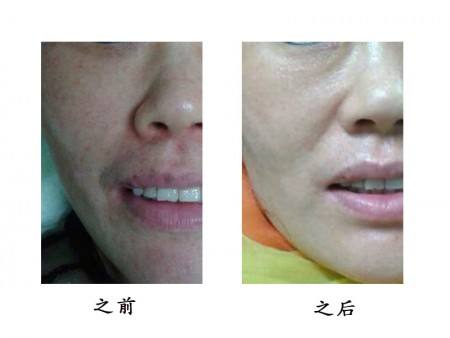 武漢注射瘦腿針醫(yī)生