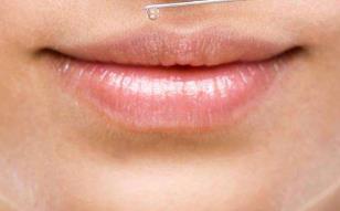 長(zhǎng)沙眼角緊致提拉醫(yī)生