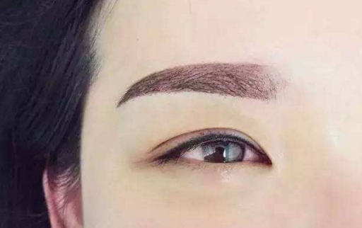 泉州眼部細紋微整醫(yī)生