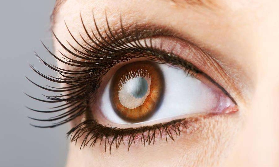 西安超微創(chuàng)眼底紋醫(yī)生