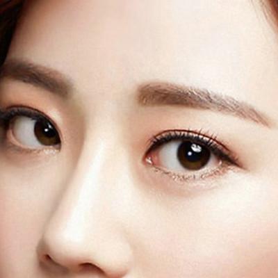 貴陽去除細(xì)紋醫(yī)生