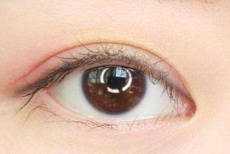 長(zhǎng)沙激光去痘痘疤痕醫(yī)生