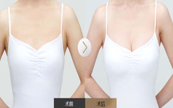 上海做內(nèi)切眼袋手術(shù)醫(yī)生