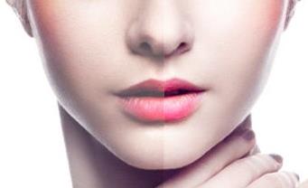 泰安玻尿酸去深皺紋醫(yī)生