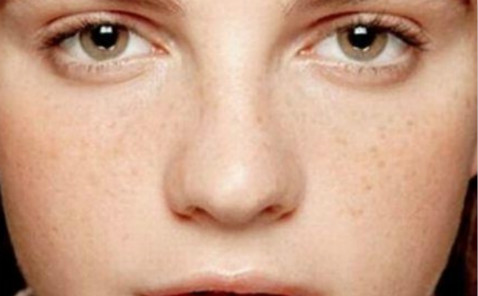 貴陽平自體脂肪隆胸醫(yī)生