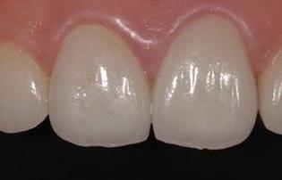 武漢面部負壓吸脂醫(yī)生