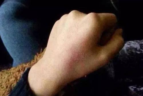 南京注射除細紋醫(yī)生