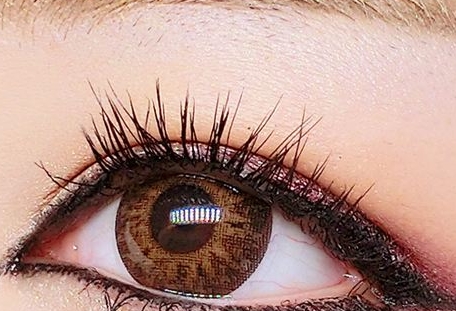 青?；瘜W(xué)剝脫祛鮮紅斑痣醫(yī)生