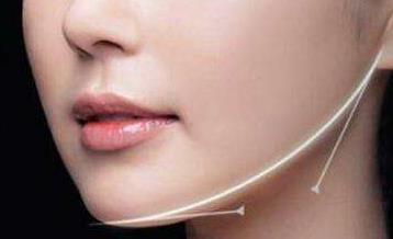 西安膠原蛋白祛妊娠紋醫(yī)生