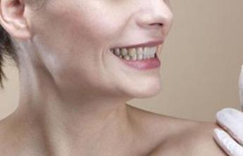 鄭州自體脂肪額頭填充醫(yī)生