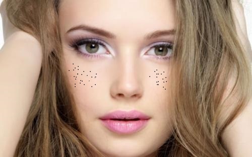 洛陽瘦臉針進(jìn)口品牌醫(yī)生