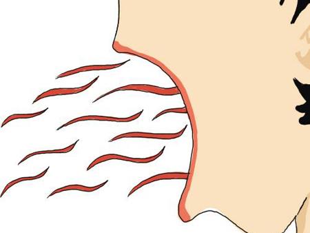 南通淡化老年斑醫(yī)生