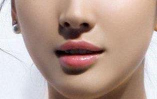 東莞祛動態(tài)細紋手術醫(yī)生