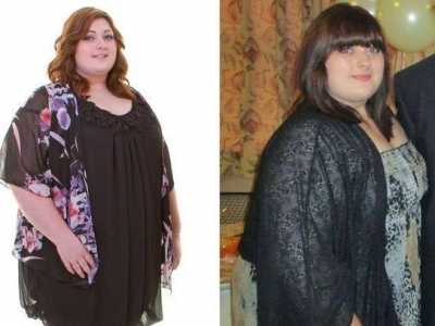 長(zhǎng)沙抬頭紋填充醫(yī)生