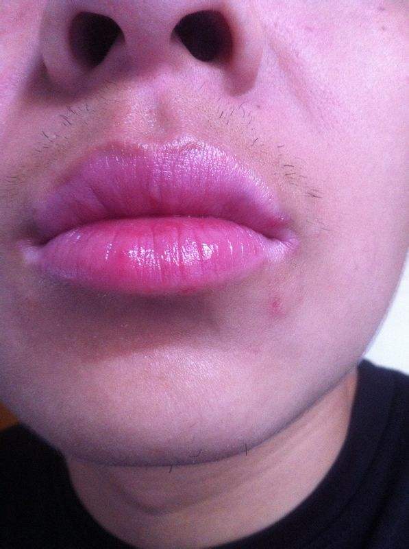 南京手術(shù)消除眼底靜態(tài)紋醫(yī)生