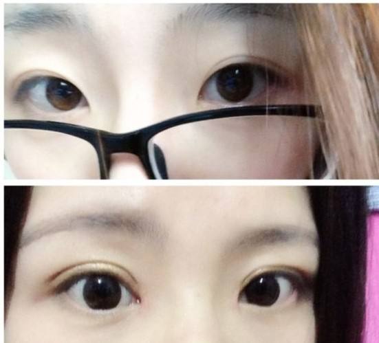 武漢玻尿酸去皺醫(yī)生