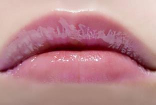 蘭州去痘坑醫(yī)生