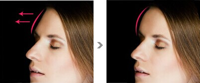 邵陽(yáng)小耳畸形治療醫(yī)生