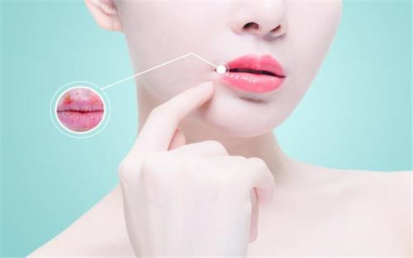 咸陽(yáng)超皮秒祛印第安紋醫(yī)生