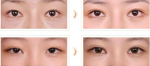 西安做深藍瘦臉醫(yī)生