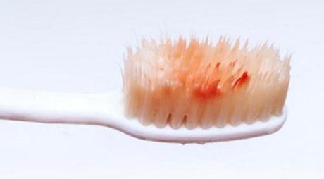 武漢朝天鼻矯正醫(yī)生