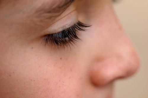 無錫膠原蛋白填充川字紋醫(yī)生