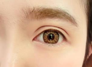 上海眼部熱瑪吉祛細(xì)紋醫(yī)生