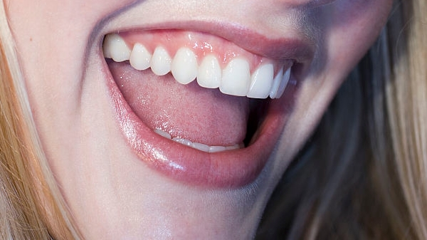 長沙注射填充抬頭紋醫(yī)生