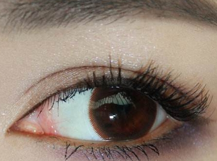 咸陽(yáng)面部色素斑醫(yī)生