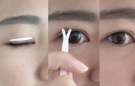 中山韓式豐唇醫(yī)生