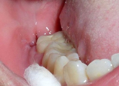 2023南寧地區(qū)五家頂尖牙科醫(yī)院排名揭曉，備受贊譽(yù)！