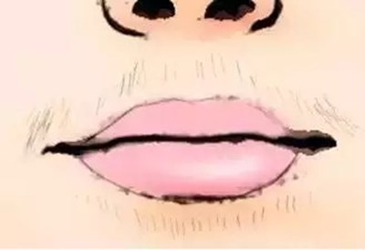 2023年上海七家面部抽脂?？漆t(yī)院一覽