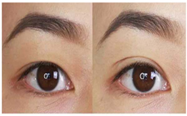 2023年亳州地區(qū)最受矚目的吸脂手術(shù)醫(yī)院盤點(diǎn)，前三強(qiáng)醫(yī)院非常值得關(guān)注！