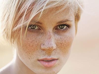 銀川射頻電波拉皮醫(yī)生