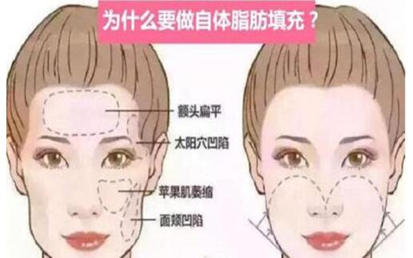 2023全國頜面整形醫(yī)生排名榜單發(fā)布！這些專家醫(yī)生值得關(guān)注