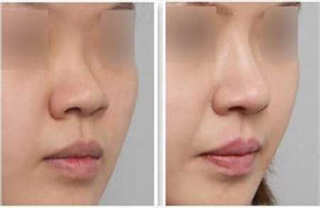 2023年濰坊凹凸曼皮膚修復中心盤點，領先六大醫(yī)院入圍 - 坤娜、華美獨占鰲頭