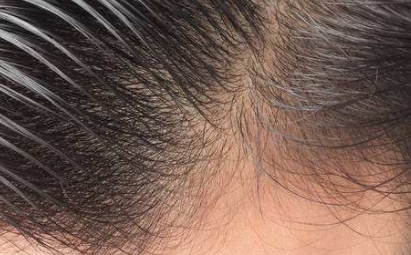 2023年棗莊去眼袋醫(yī)院排行榜最新整理，公立醫(yī)院與私立醫(yī)院綜合評價對比!