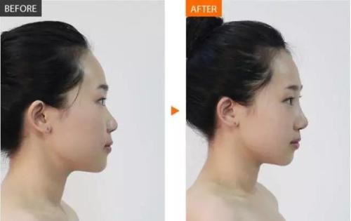 2023年成都做鼻部整形手術(shù)的專家名單公布，了解最可靠的整形醫(yī)生！