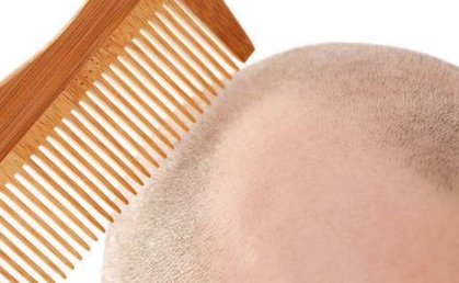 2023年南京口腔矯正醫(yī)院排行榜公布！這三家醫(yī)院上榜了！