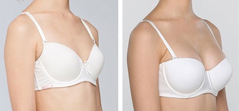 貴陽肉毒素去皺紋醫(yī)生