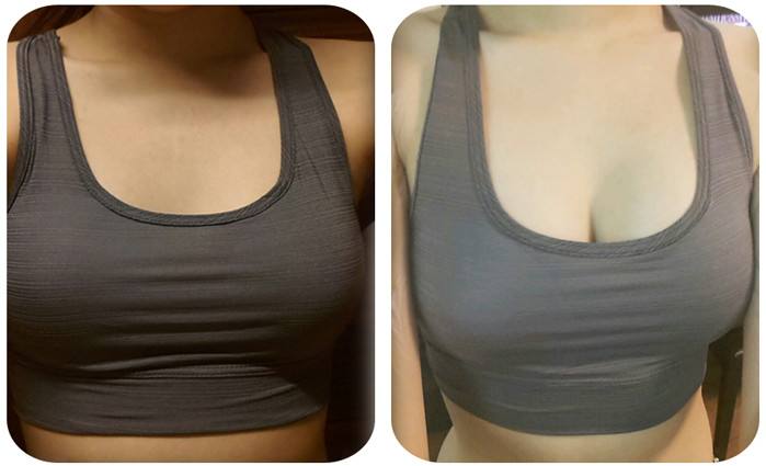 寧波嗨體祛黑眼圈醫(yī)生