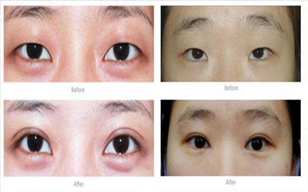 2023年最受推崇的臺(tái)州吸脂醫(yī)院排行，建議要改變身形的朋友不可錯(cuò)過(guò)！