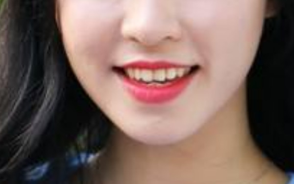 2023年日照洗紋身醫(yī)院評價排行榜，你值得信賴的口碑推薦！