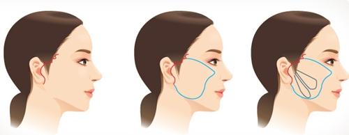 2023年淮安整形醫(yī)院近五年中綜合回顧，美麗殿堂華麗揭幕，蘇王獨領前列！