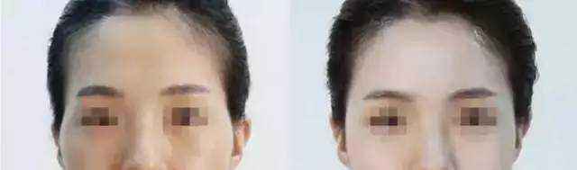 2023年鹽城抽脂整形醫(yī)院排行榜發(fā)布，排名靠前的醫(yī)院真是讓人驚喜，快來了解一下！