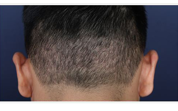 2023年北京豐胸整形排名：綜合評(píng)價(jià)前五強(qiáng)醫(yī)院揭曉！