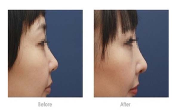 2023年長沙頂級整形醫(yī)院盤點：卓越、芳華、華麗居榜單前列！